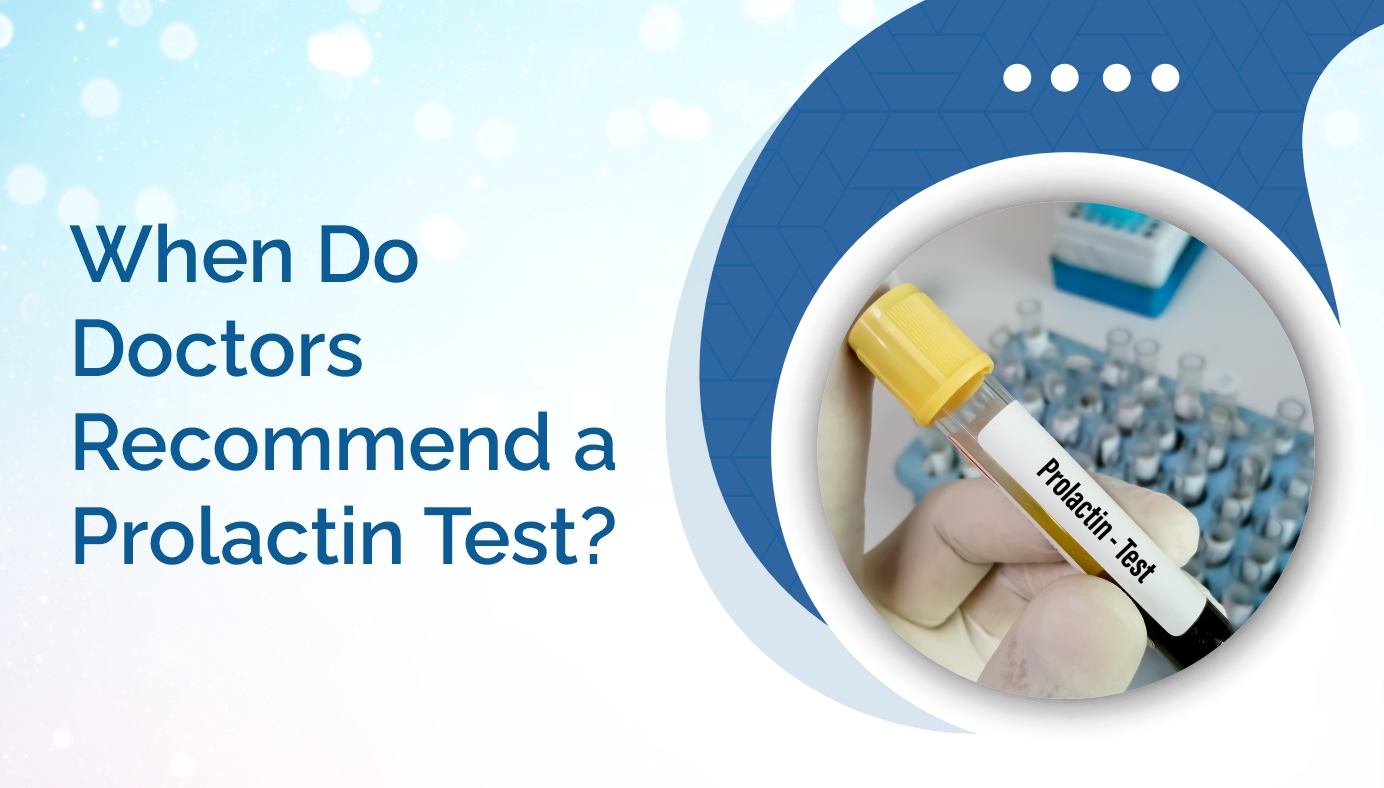 When Do Doctors Recommend a Prolactin Test?